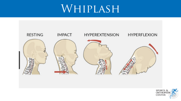 WHIPLASH 